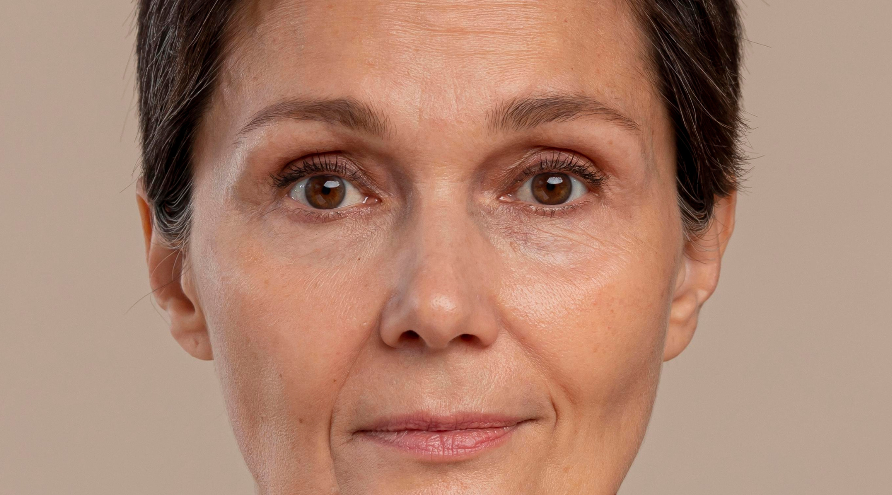 Dark Circle on face