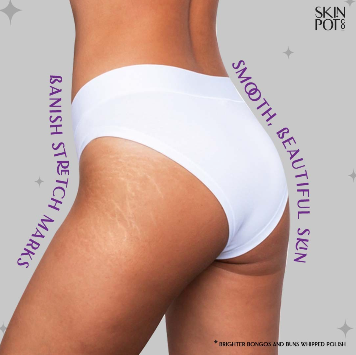 Banish Stretch Mark Skin
